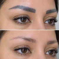 پاک کردن تتو های سیاه و رنگی ..پاکسازی وکربن تراپی