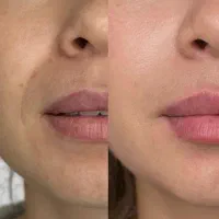 کرم جوانه گندم اصل معجزه جوانی استاد زارعی