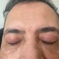 عمل زیبائی پلک چشم|خدمات آرایشگری و زیبایی|فولادشهر, فولادشهر|دیوار