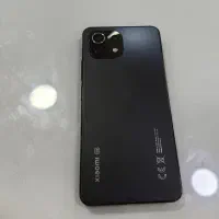 Mi11 lite
