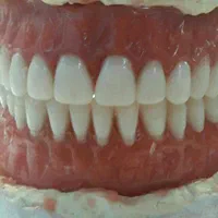 خدمات تخصصی دندانسازی ساخت دندان مصنوعی ژله ای|خدمات آرایشگری و زیبایی|اندیشه, اندیشه فاز ۱|دیوار