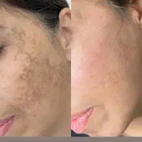 نمایندگی سرم 15 کاره مغذی لاکچری کوین منافذ ضدلک|حراج|مشهد, ایثار|دیوار