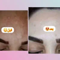 پاکسازی وفیشیال تخصصی پوست خانمهاوآقایون|خدمات آرایشگری و زیبایی|بهبهان, |دیوار