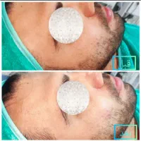فیشال تخصصی و درمانی آقایان|خدمات آرایشگری و زیبایی|اهواز, اهواز|دیوار