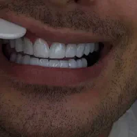 کامپوزیت با شرایط اقساط