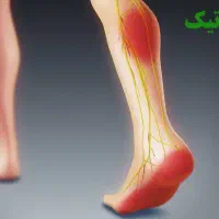 ماساژ درمانی بادکش حجامت تضمینی|خدمات آرایشگری و زیبایی|سنندج, |دیوار