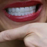 کامپوزیت،لمینیت اقساط 2 تا 12 ماهه|خدمات آرایشگری و زیبایی|بومهن, |دیوار