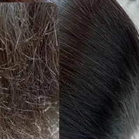انجام کلیه خدمات موخوره گیری