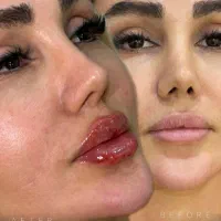 مطب زیبایی تپش .جشنواره تخفیف/لیزر/ژل بوتاکس|خدمات آرایشگری و زیبایی|گلبهار, شهر جدید گلبهار|دیوار