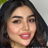 فیلربینی زاویه فک ژل لب روسی تکنیکMام دکترمهسازرین