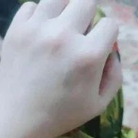 سفید کننده ضدلک اصل تضمینی حاوی گلوتاتیون بشدت قوی|آرایشی، بهداشتی، درمانی|بم, |دیوار