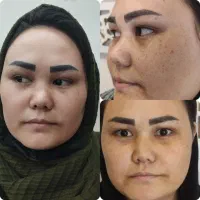 جشنواره تخفیف عمل تیپ پلاستی وبلفارو ابدو ساکشن|خدمات آرایشگری و زیبایی|مشهد, توس (بلوار توس)|دیوار