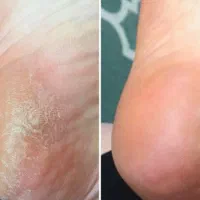 بندرامام خمینی