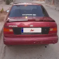 هیوندای اکسل تمیز و روپا