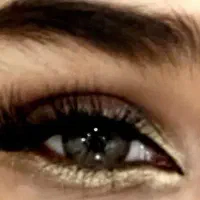 کاشت مژه هیدن