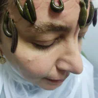 تخفیف۵۰٪ حجامت، فصد پیشانی، زالو، غلظت واریس دیسک|خدمات آرایشگری و زیبایی|اصفهان, برازنده|دیوار