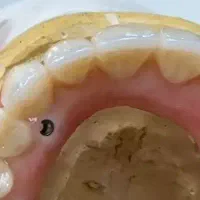 دندانسازی امید