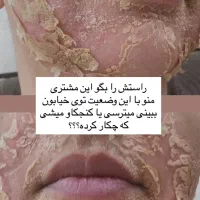 پوست روشن را از ما بخواهید|خدمات آرایشگری و زیبایی|رشت, گلسار|دیوار