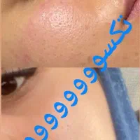 مثل کره چربی بسوزون و به اندام ایده آلت برس|آرایشی، بهداشتی، درمانی|جیرفت, |دیوار