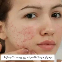 حراج حراج  صابون کاج و مریم گلی، ضد جوش