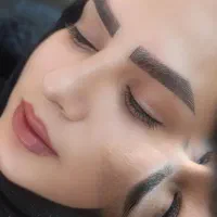 تخفیف ویژه میکرووژل بوتاکس