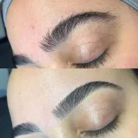 آموزش وانجام اپیلاسیون حرفه ای