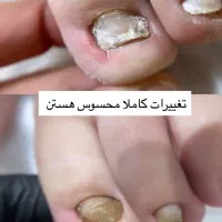 دستیار ناخنکار وپدیکوریست و پودولوژیست