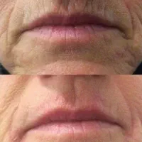 بینظیر|آرایشی، بهداشتی، درمانی|خرم‌آباد, |دیوار