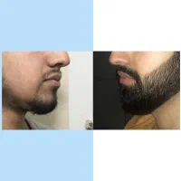 ابهت چهرتو بساز