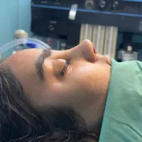 عمل زیبایی بینی