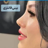 جشنواره جراحی بینی لیفت سینه صورت شکم اسلیو وبایپس|خدمات زیبایی و سلامت|تهران, میدان ولیعصر|دیوار