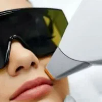 جشنواره لیزر رفع موهای زائد مطب زیبایی