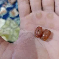 مهره زیرخاکی