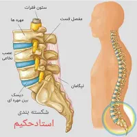 شکسته بند،طب سنتی استادحکیم