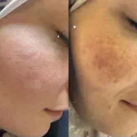 پک کامل ضدلک