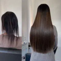 اکستنشن لیزری اکستنشن بافت واکستنشن لمه و ریمو