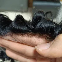 پروتز مو کاشت مو