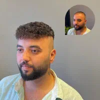 پروتز مو معجزه زیبایی|خدمات آرایشگری و زیبایی|اصفهان, ملک|دیوار