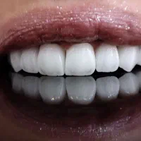 دندانپزشکی - ایمپلنت - کامپوزیت - عصب کشی|خدمات زیبایی و سلامت|تهران, شهرک پرواز|دیوار