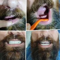 دندان مصنوعی اقساطی