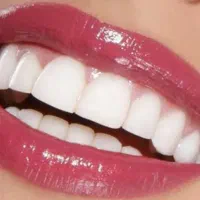 اگر امروز به دندانهایت توجه نکنی فردا دیره|خدمات آرایشگری و زیبایی|رفسنجان, |دیوار