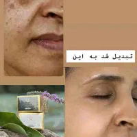 کرم های روز و شب لاکچری کوین