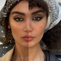 تخفیف ویژه کلینیک زیبایی|خدمات آرایشگری و زیبایی|اردبیل, |دیوار