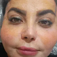 جراحی سرپایی