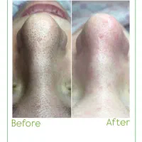 تخفیف ویژه بوتاکس فیلر فیشال لیزر فیشیال ژل|خدمات آرایشگری و زیبایی|فردیس, شهرک ۱۱۰|دیوار