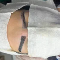 کاشت ابرو وکاشت مو فقط 15 میلیون