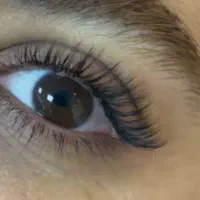 کاشت مژه