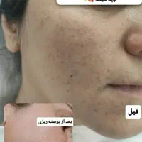 مدل کاشت ناخن و فشیال و اصلاح|خدمات آرایشگری و زیبایی|پرند, فاز ۴|دیوار