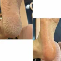 انجام خدمات فیشال تخصصی و پدیکور|خدمات آرایشگری و زیبایی|اهواز, شهرک حفاری|دیوار