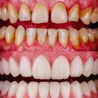 لیمنیت تحویل سه روزه
